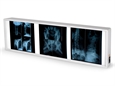 NEGATIVOSCOPIO TRIPLO 38 x 122 cm