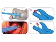 PINZA BIOPSIA GYN&PUSH 21,5 cm - sterile