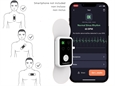 ECG CARDIONICA A 1 CANALE CON AFIB e BLUETOOTH