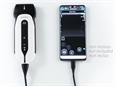 SONOEYE P2 DOPPLER DIGITALE A COLORI - Sonda Linear Array