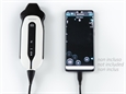 SONOEYE P3 DOPPLER DIGITALE A COLORI - Sonda Phase Array