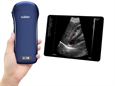 ECOGRAFO PORTATILE LINEARE/CONVESSO/CARDIACO 3 IN 1 WIRELESS VIATOM